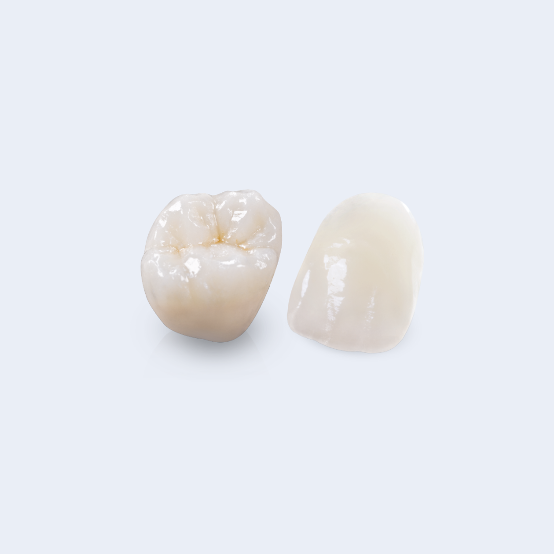 Porcelain veneer restorations